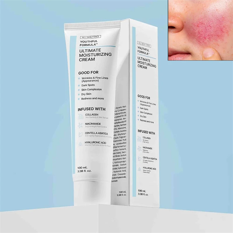 

Восстанавливающий крем для лица, улучшающий чувствительную кожу, сухость, увлажняющий крем, увлажняющий успокаивающий лосьон для удаления розацея, корейская косметика