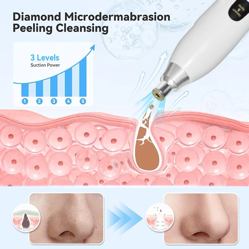 2025 Nieuwe Diamond Micro-Dermabrasie Machine Huidverzorging Gezicht Schoonheid Apparaat Peeling Vacuüm Comedondrukker voor Thuisgebruik