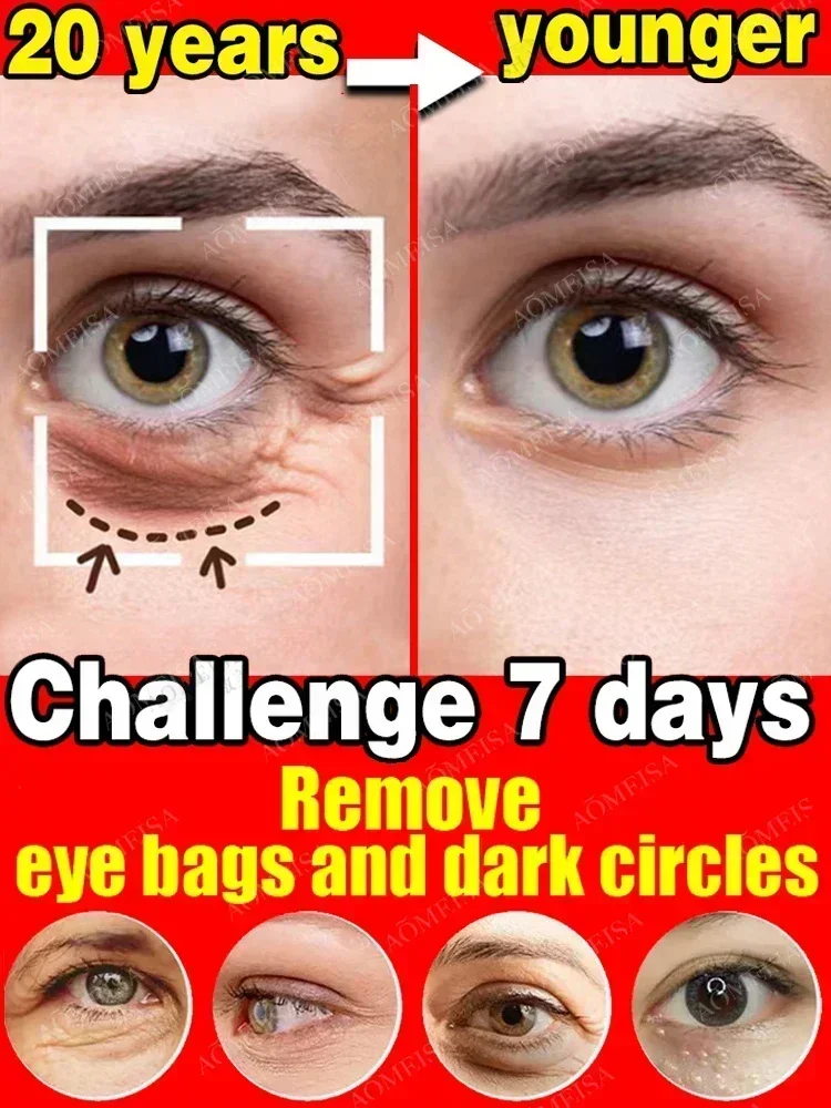 

New 7 Day Tighten Wrinkles Eye Cream Anti Dark Circles Bags Puffiness Fade Eye Fine Line Whiten Under Eyes Skin Korean Care