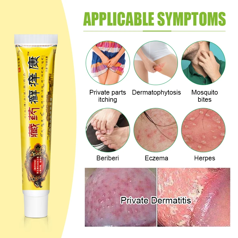 1Pcs Psoriasis Cream Antibacterial Herbal Plaster Dermatitis Eczematoid Eczema Ointment Treatment Psoriasis Skin Care Cream S050