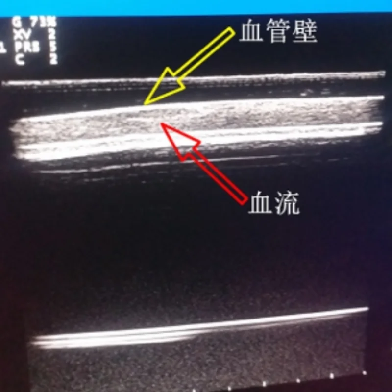 Modelo de punción vascular guiada por ultrasonido PICC B Módulo de punción de entrenamiento intervencionista por ultrasonido + bomba de circulación