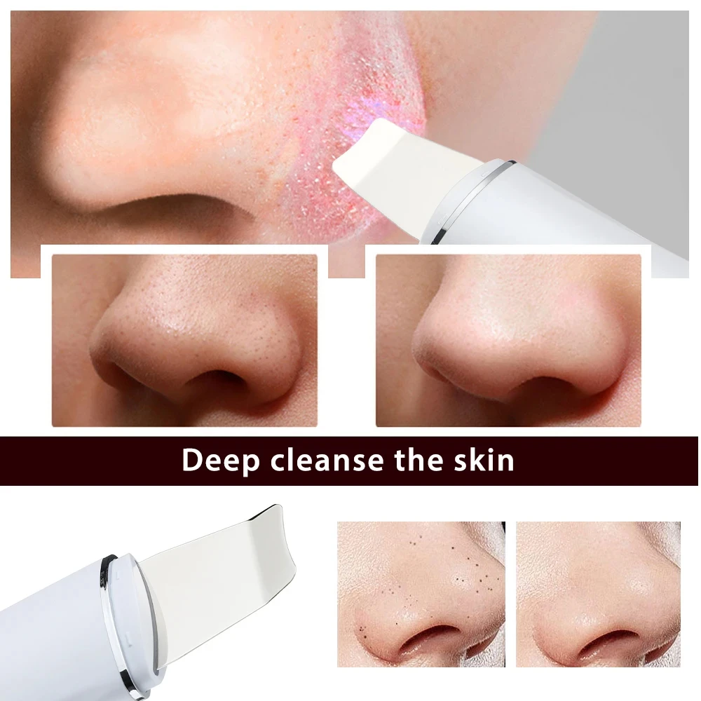 Ultrasone Huid Scrubber Mee-Eter Verwijderaar Gezichtsreiniger 4 Modi Peeling Schep Face Lifting Tool Ems Spatel Diepe Reiniging