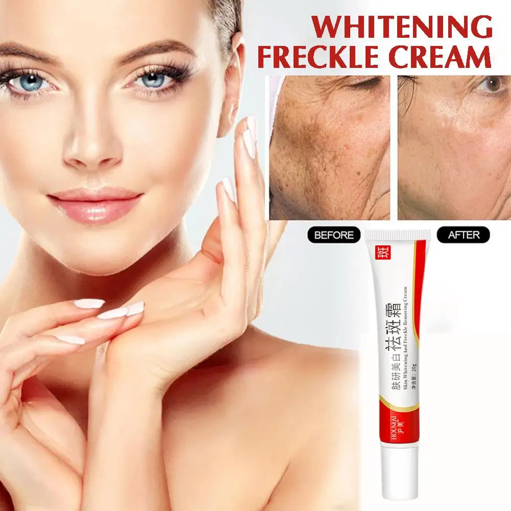 20g Whitening Freckle Cream Remove Dark Spots Anti Creams Face Care Pigmentation Brighten Skin Niacinamide Freckle Fade Mel Y2c9