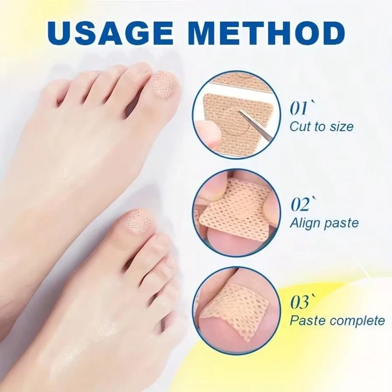 32Pcs Toenail Fungus Patch Waterproof Nail Repair Patches Nail Ingrown Correction Sticker Discolored Damaged Nail Foot Care Too