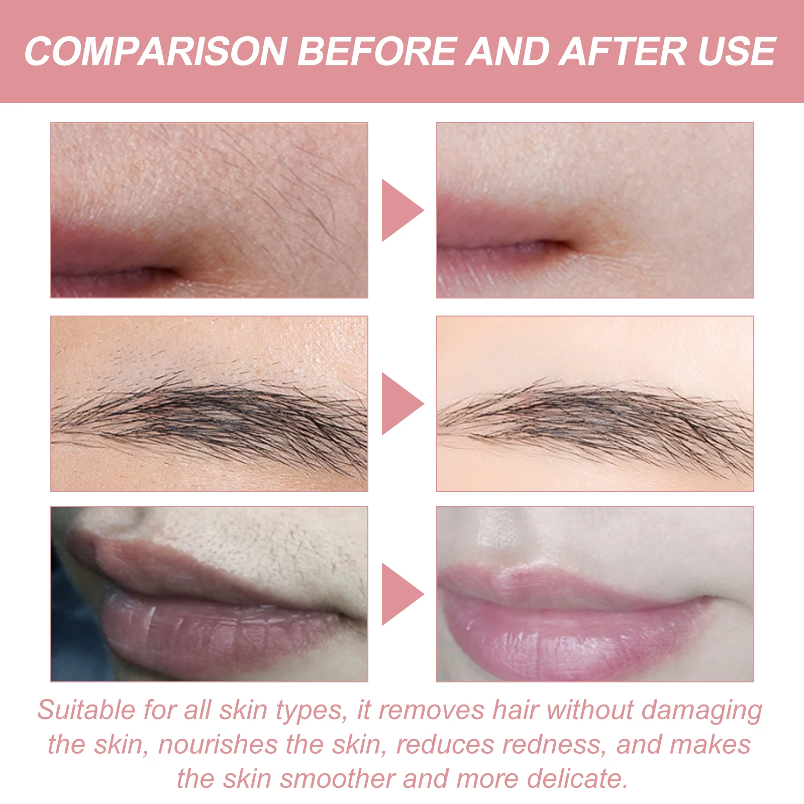 Ouhoe Peach Face ครีมกําจัดขนอ่อนโยนไม่ระคายเคือง Face Moisturizing ลดรอยแดง Smoothing Softening Hair Remove ครีม