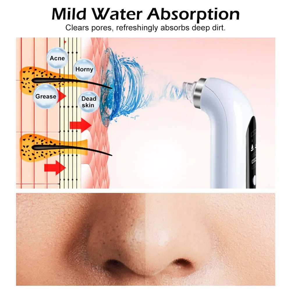 Microbubble Blackhead Remover Vacuum Suction Rechargeable Small Bubble Pore Acne Skincare Electric Face Nose Cleaner Device