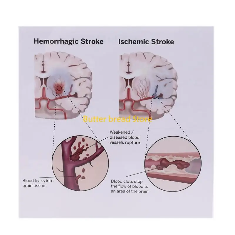 

W89C Разобранная анатомическая анатомическая модель сердца человека в натуральную величину для учебного преподавания