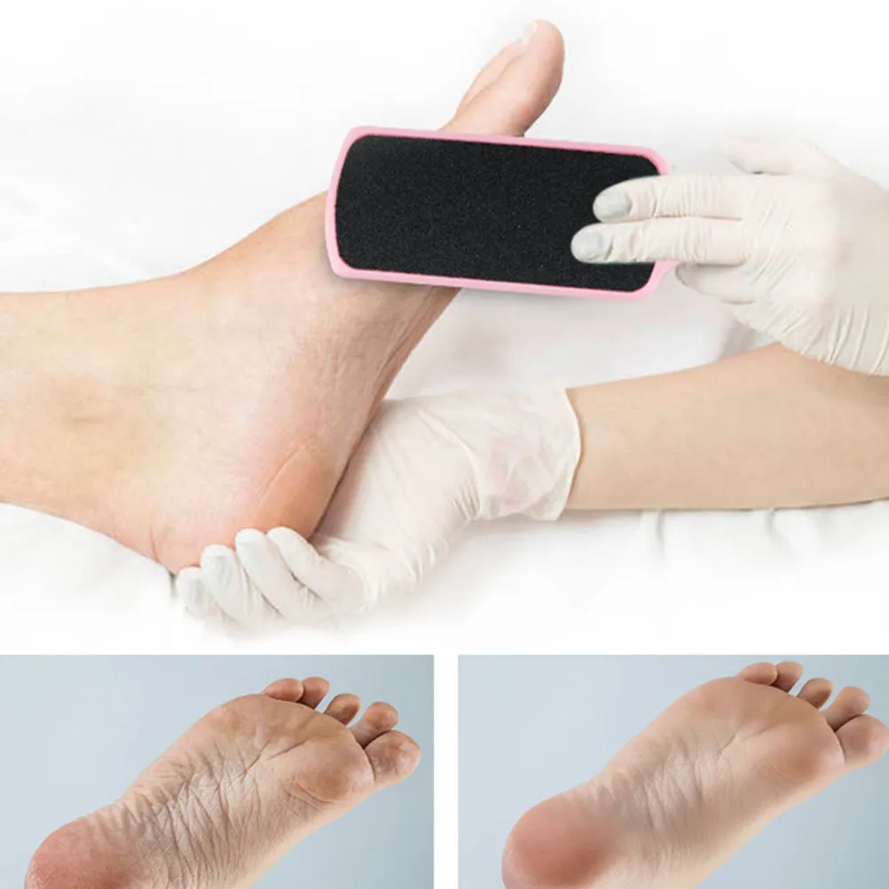 6Pcs Foot Callus Remover Plastic Double-Sided Exfoliating Foot File Dead Skin Remover Pedicure Tool Soft Smooth Skin