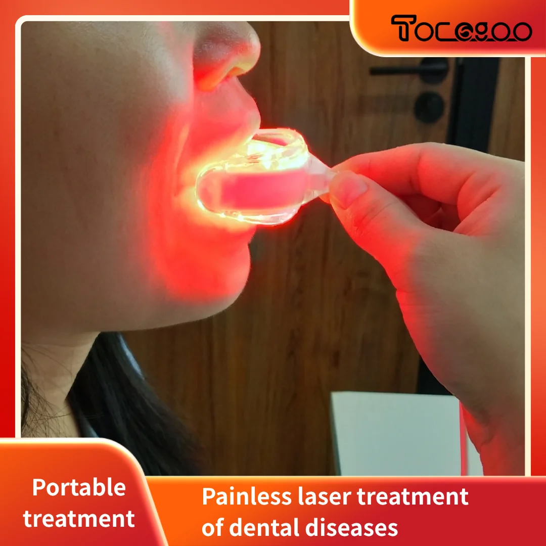 

Светодиодная лампа, инфракрасное оборудование 650 нм, USB-интерфейс, лечение заболеваний полости рта и зубов в любое время, остановить от карниза зубов.