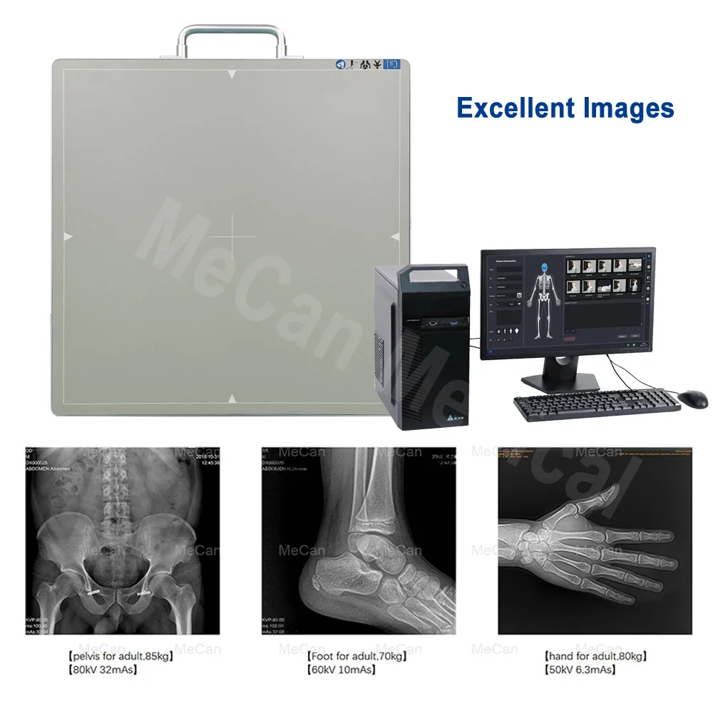 Digital X-ray flat panel detector flat panel FPD