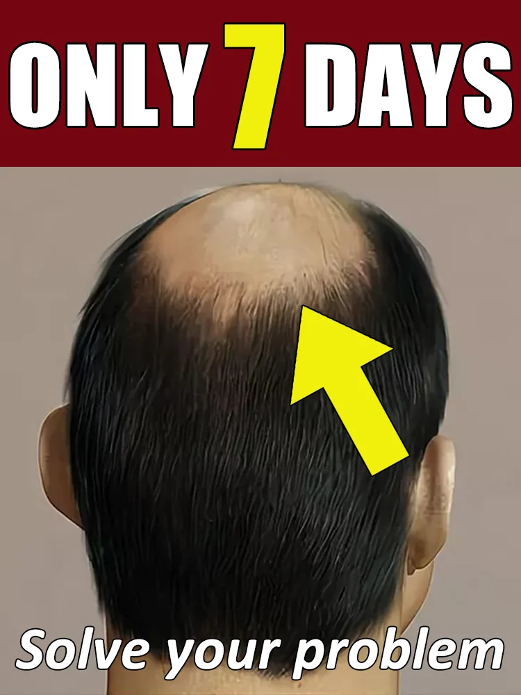 Generation-2,M-shaped,to solve hair problems and protect your scalp health,care tool,Reduce your worries