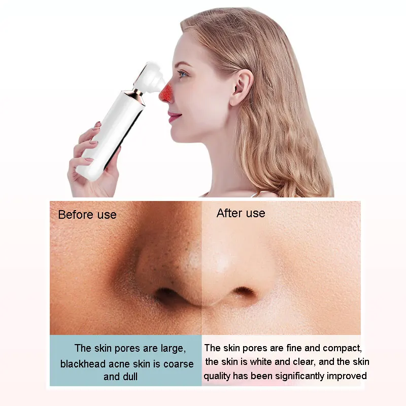 Visible Electric Blackhead Remover Vacuum Cleaner Black Head Machine WiFi HD Camera Facial Pore Cleaser Microdermabrasion Device