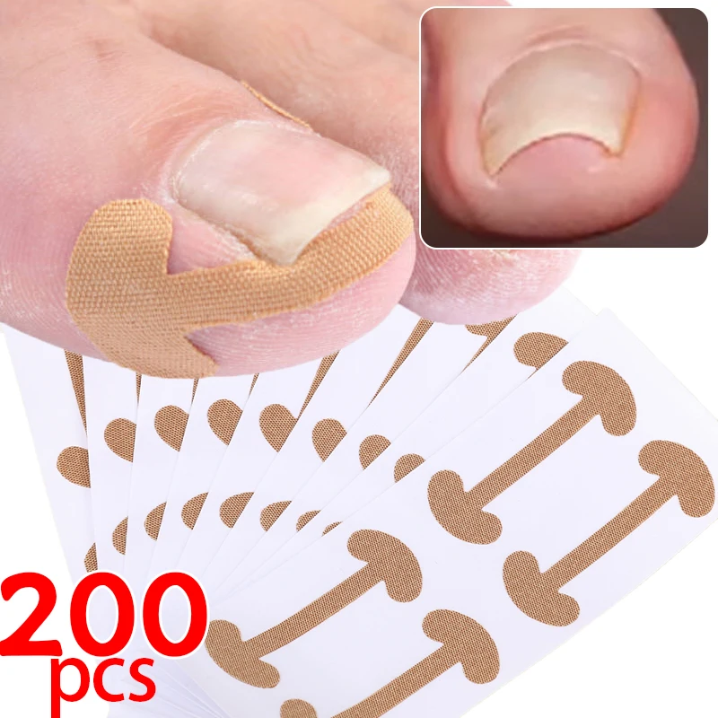 5/50sheet Ingrown Toenail Correction Strips Toe Treatment Pads Adhesive Toenail Patch Foot Health Care Corrector Pedicure Tools