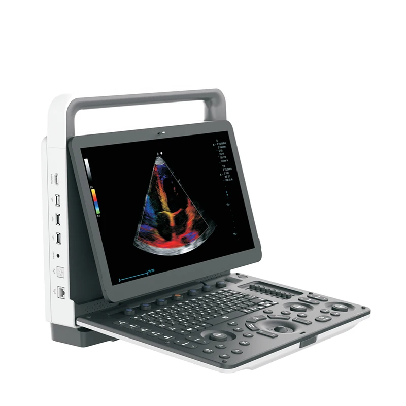 YSB-M70 Medical portable color doppler ultrasound scanner 3 activated transducer connectors 4D portable ultrasound machine