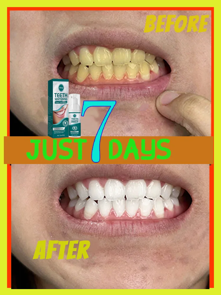 

Teeth Whitening Remove Tooth Stains Tartar Prevent Pigmentation Bleach Cleaning Odor Fresh Breath Oral Hygiene Care Tools