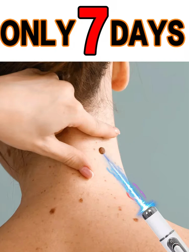 

Blue light wart tool, more discounts on sets