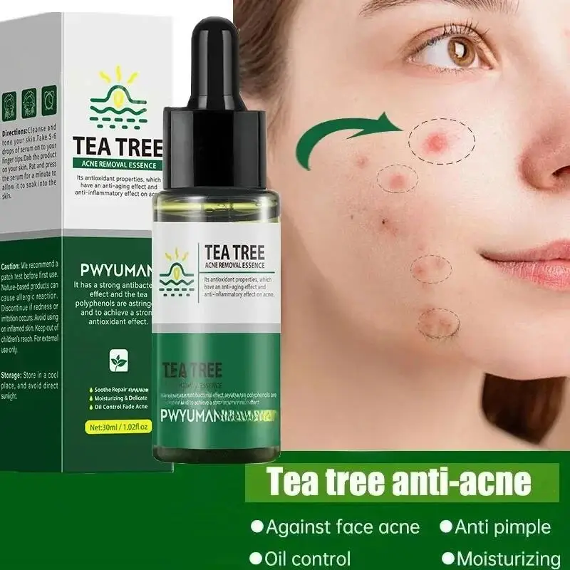 Teebaum Akne Entfernung Serum Reparatur Pickel Flecken Schrumpfen Poren Entfernen Mitesser Gesichts Reinigung Verblassen Akne Marken Bleaching Haut