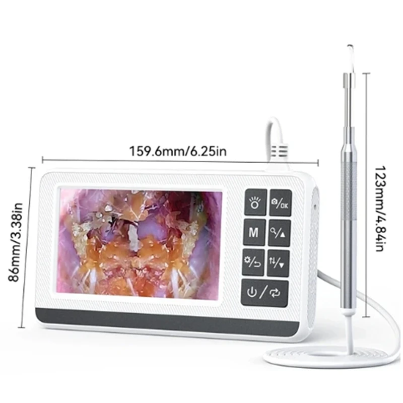 Цифровой отоскоп 3,9 мм, экран уха, 4,3 дюйма для очистки, умная визуальная палочка для сбора ушей, 30 МП, тип C, ушная камера