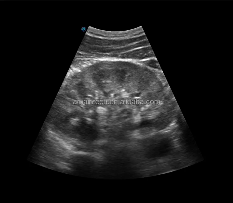 Sonoscape E2 Fabrieksprijs Laptopscanner Ultrasone diagnostische apparatuur Machine Draagbaar