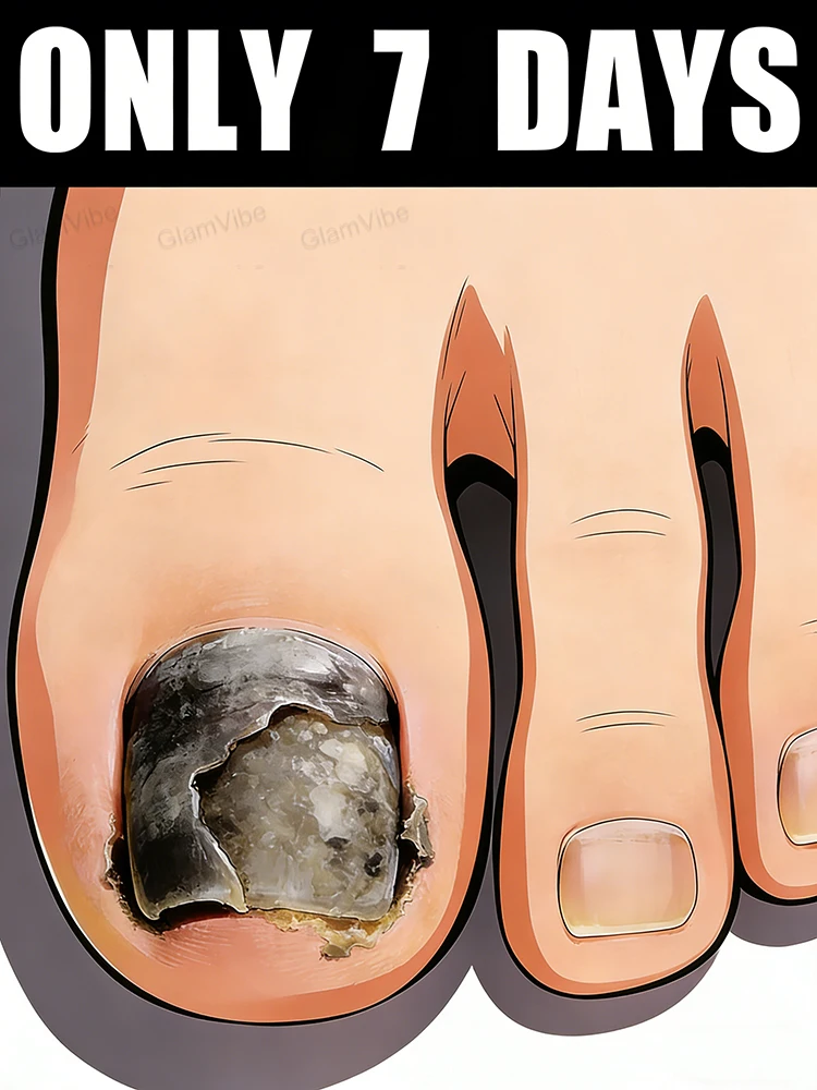 

Say goodbye to yellowing and dullness, cultivate transparent and shiny nails!