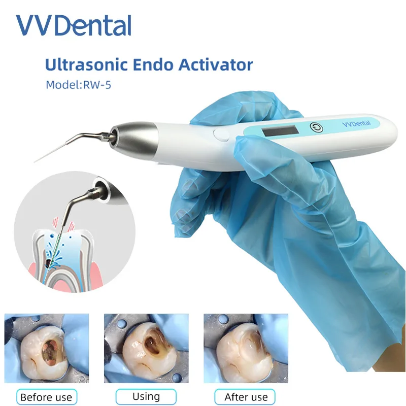 LED Dental Endo Activator Wireless Ultrasonic Activator Endo Activator Ultrasonic Washing Tooth with 5 Tips Dentistry Tools