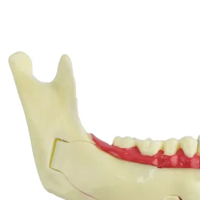 

Orthodontic Braces Dental Mandibular Tissue Teeth Demonstration Anatomical Model Patient Study Teach Decomposition Model