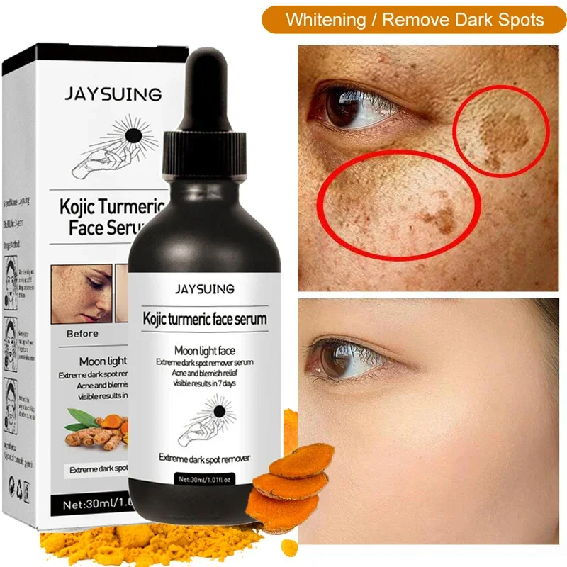 

Freckle Whitening Face Serum Turmeric Oil Fade Dark Spot Brighten Removal Pigment Melanin Correcting Essence Beauty Skin Care