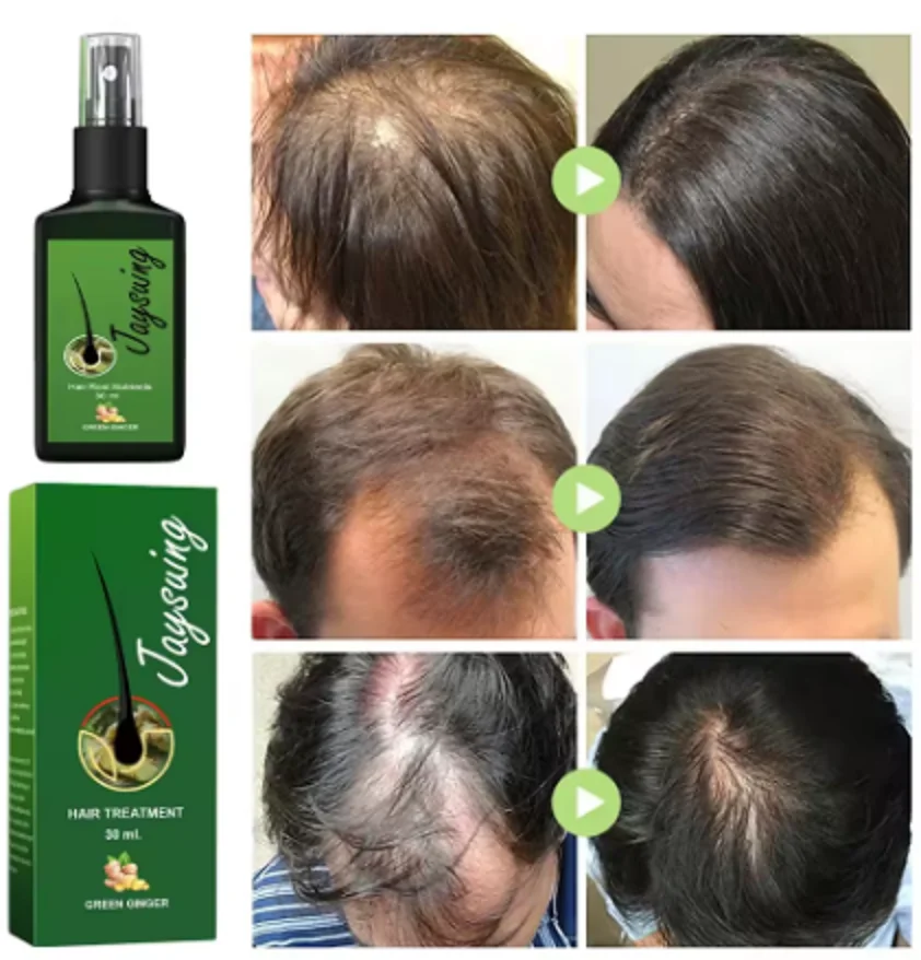 

Spray poderoso do crescimento do cabelo do gengibre, Soro anti-perda, Tratamento danificado do couro cabeludo, Reparação do prod