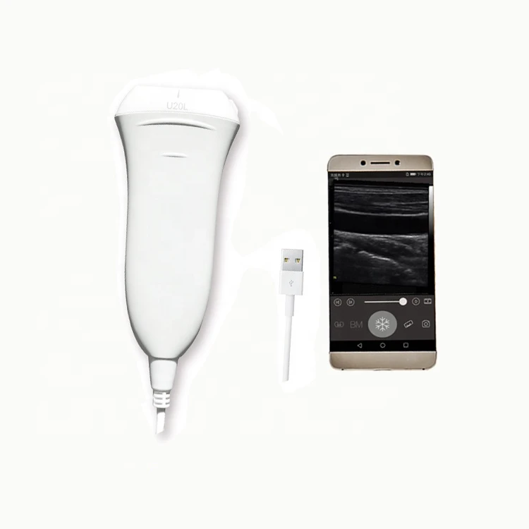 

Upgrade Handheld Pocket USB Type C Linear Ultrasound Scanner Probe With Ultrasound Software