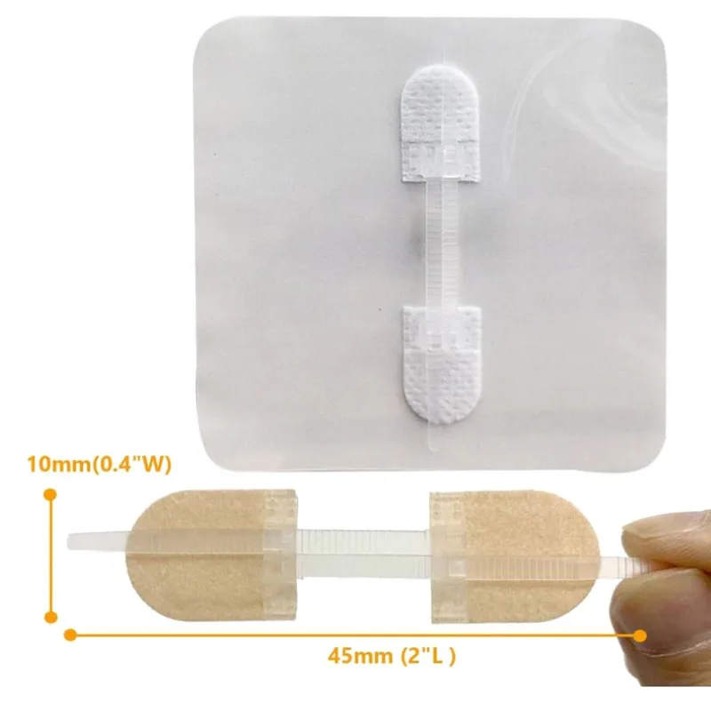 

1 шт. 45*10 мм эластичные бесшовные дышащие пластыри-застежки на молнии для закрытия ран, бинты-фиксаторы для ухода за ранами