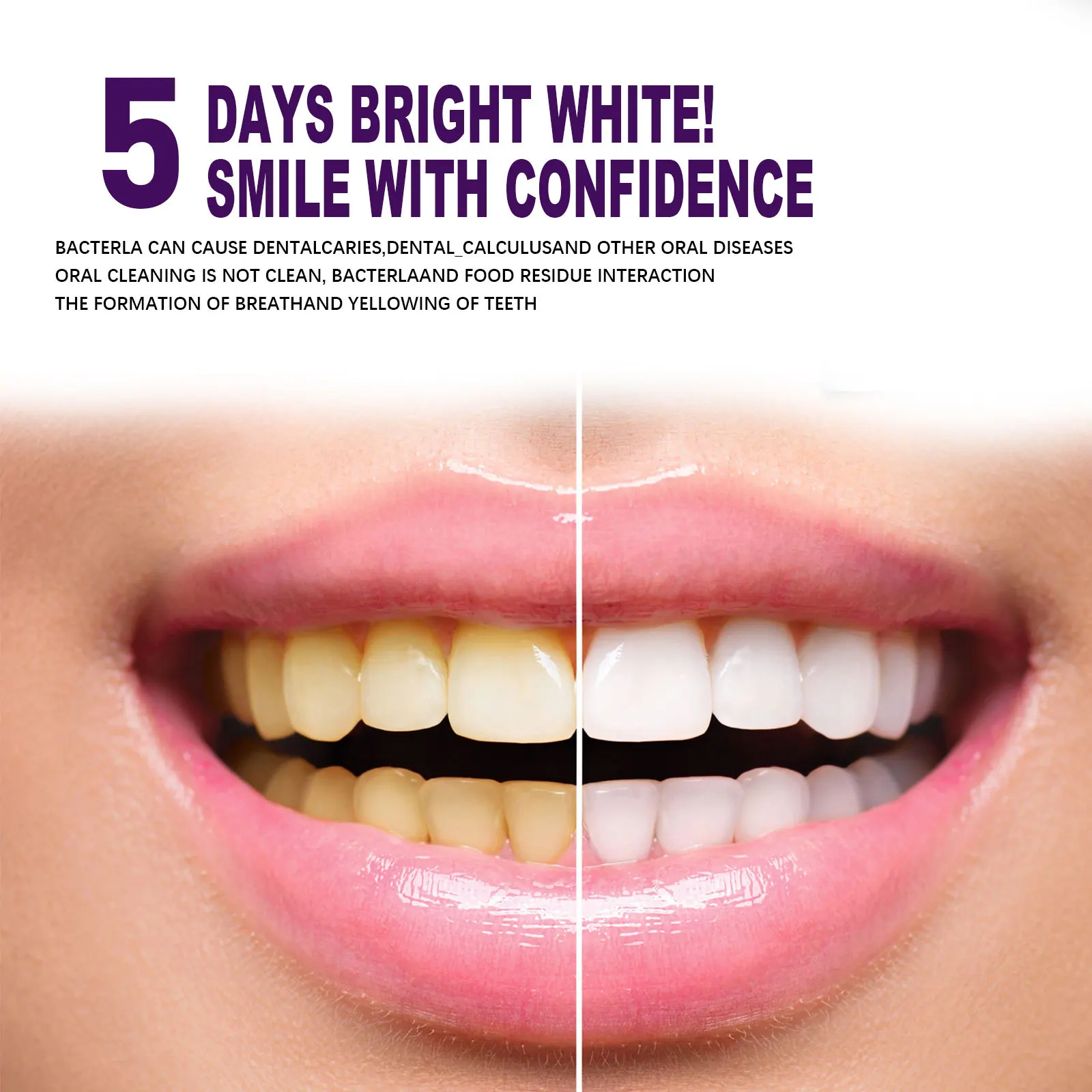 Caneta pasta de dente roxa par - Whitening Pen Bleach avaliação e preço