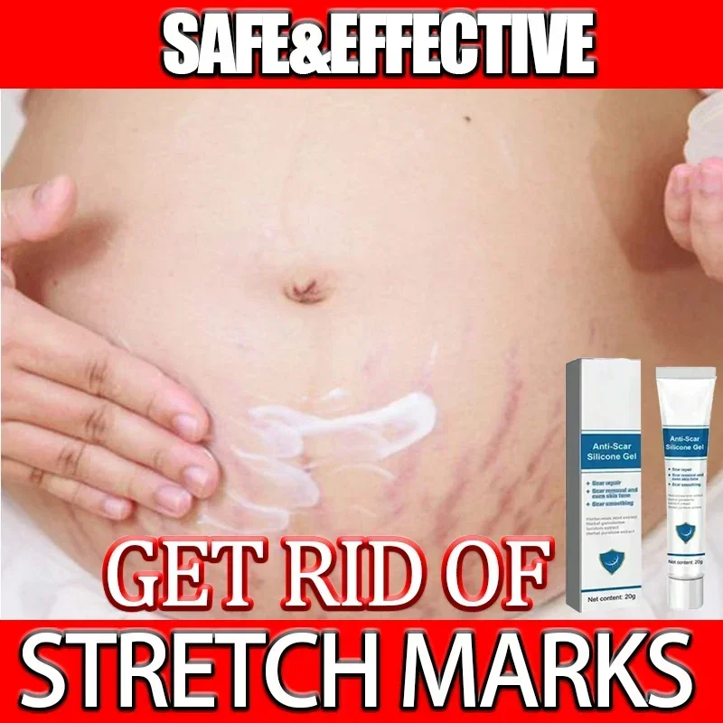 

Cream For Pregnancy Stretch Marks Removal Eliminate Red White Old Stretch Marks 0924