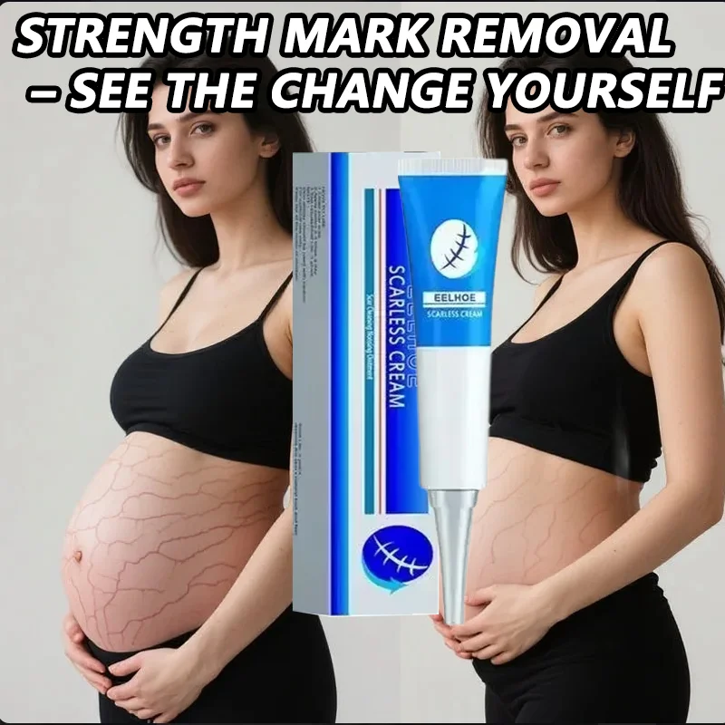 

Stretch Mark Cream Anti-wrinkle Anti-aging Maternal Skin Repair Remove Pregnancy Hydrates and moisturizes deeply Body Skin Care