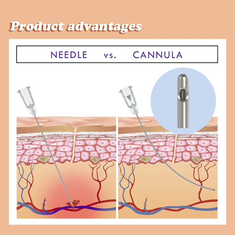 Disposable Hypodermic Fill Needle 23G 25G 27G 50mm Blunt tip Cannula With filter