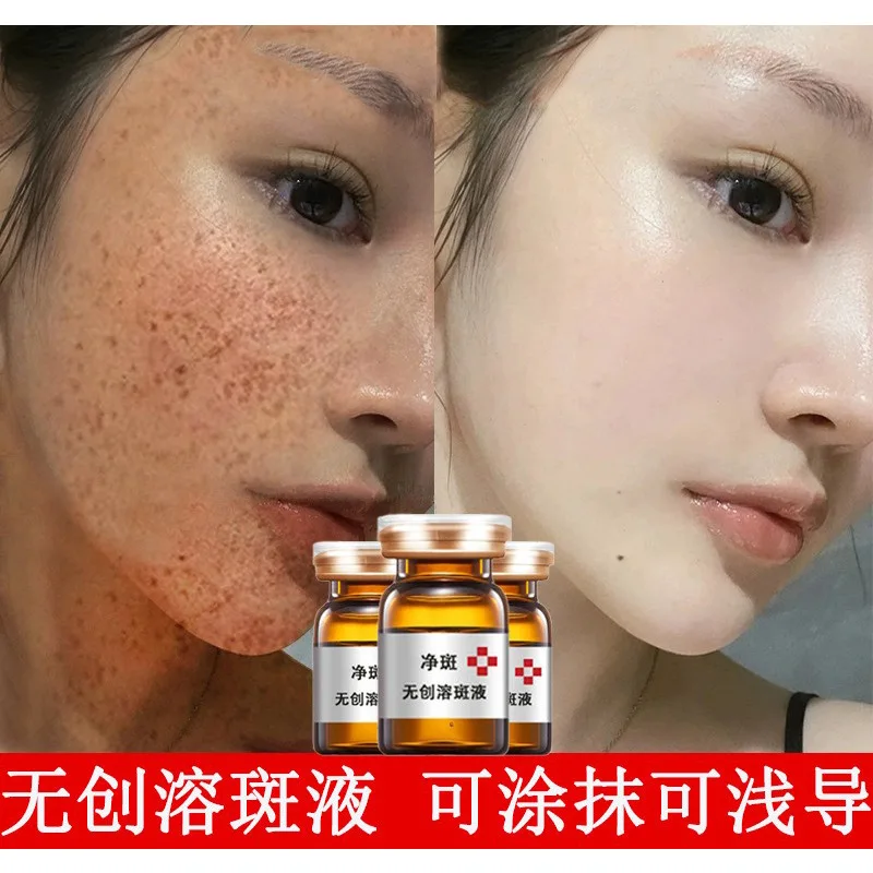 

Plaque dissolving liquid chloasma removing dermal freckles 377 freckle removing liquid whitening freckle removing essence