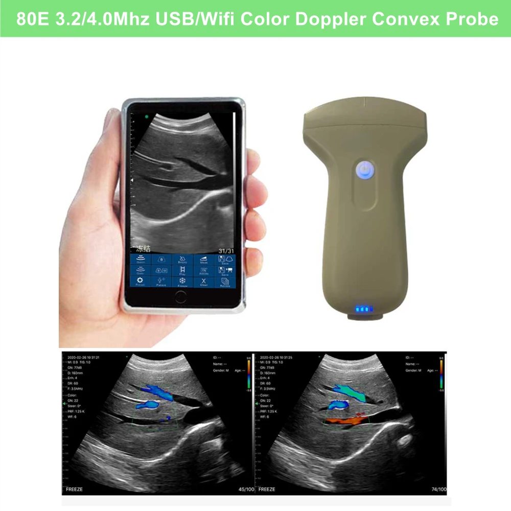 New Wireless USB Color Doppler Ultrasound Scanner Convex Linear Probe for Abdomen Cardiac Kidney Vascular Use