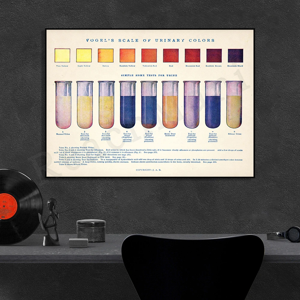 Antique Urine Charts • Unusual Bathroom Art • Vintage Biology Charts • Human Anatomy • Bizarre/weird/weird science posters