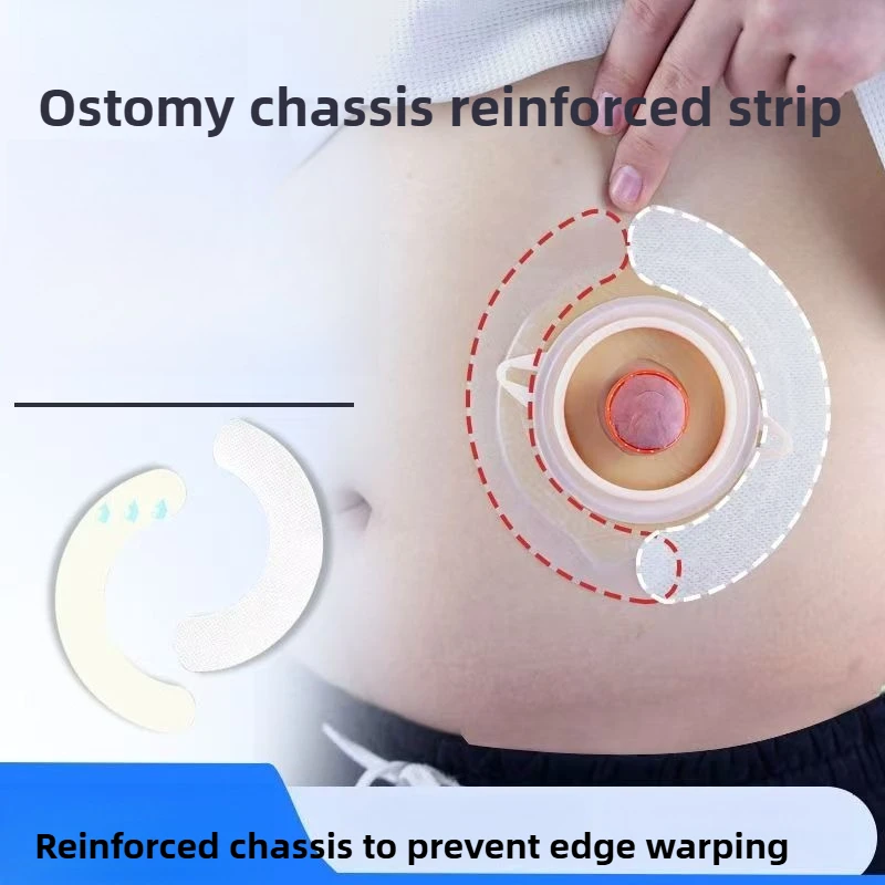 

Портативная фиксирующая лента для ухода за стомой, 20/40 шт., прозрачные ленты для фиксации колостомических мешков, предотвращают деформацию фланца и сминание