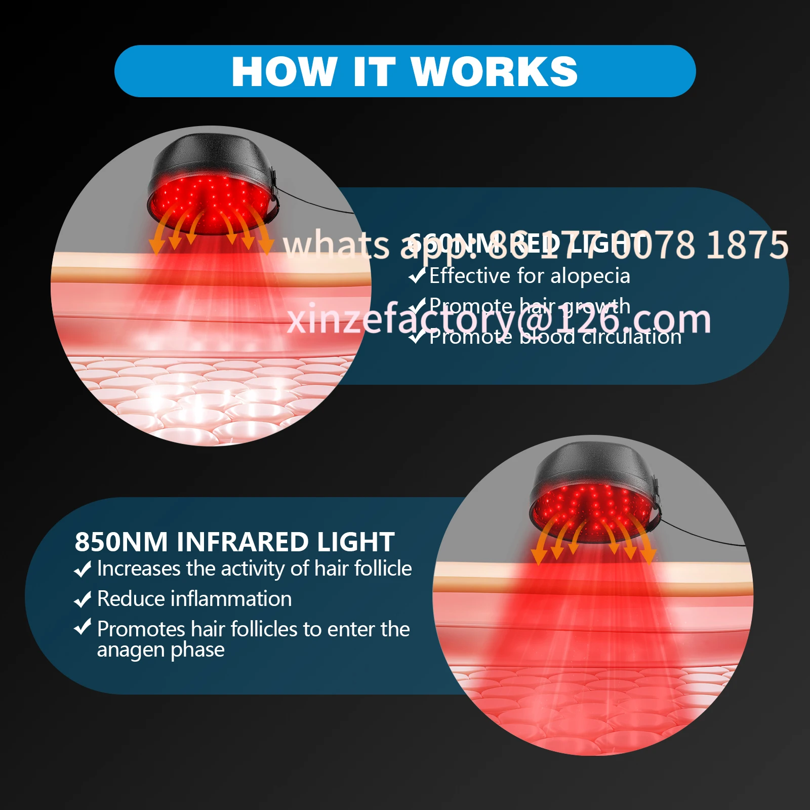 Customizable anti-hair loss stress-relief LED relaxation therapy laser cap for hair growth