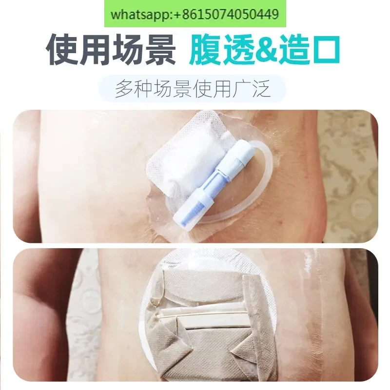 postoperative wound protective film peritoneal dialysis waterproof protective sticker large size stoma bath waterproof pu film