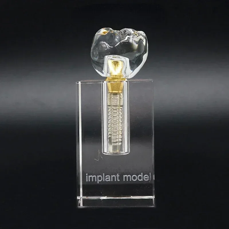 

Съемная внутренняя нижняя полость, верхняя/нижняя остатка с имплантатами, модель зубных зубов для обучения