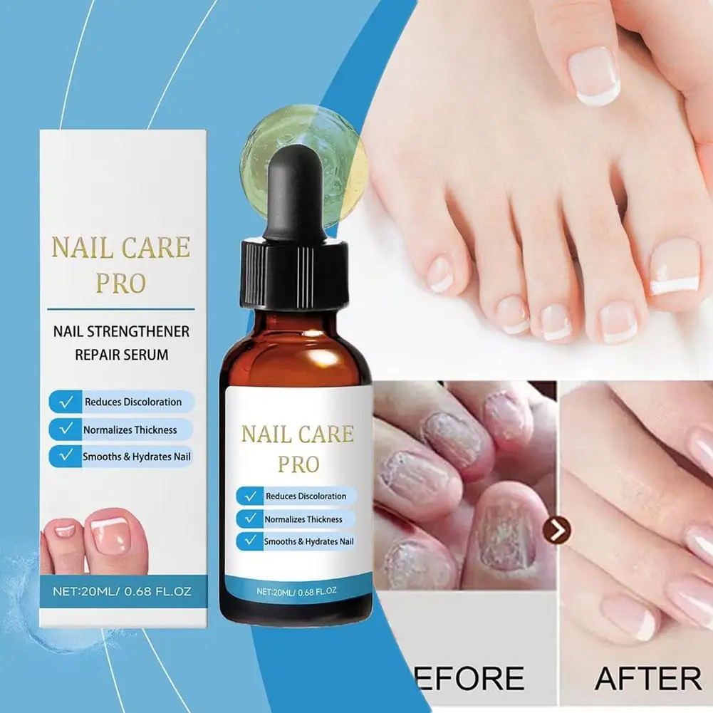 

Nail Care Pro Укрепляющая и восстанавливающая сыворотка для рук и ног уменьшает обесцвечивание ногтей, нормализует толщину