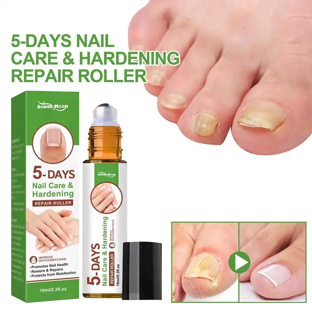 Rolo de reparo de unhas de 5 dias muda endurecimento suavizante cuidados com as unhas solução de brilho espessamento e remoção de rolo nutrição de unhas