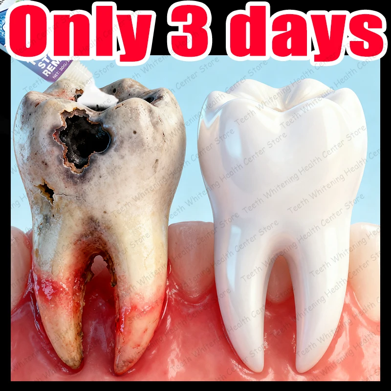 #31 New Dentures Arrivals