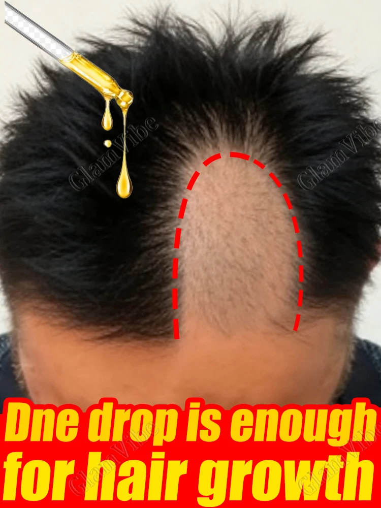 

Gentle plant-based ʜᴀɪʀ ᴏɪʟ that does not damage the scalp and promotes ʜᴀɪʀ ʀᴇɢᴇɴᴇʀᴀᴛɪᴏɴ.