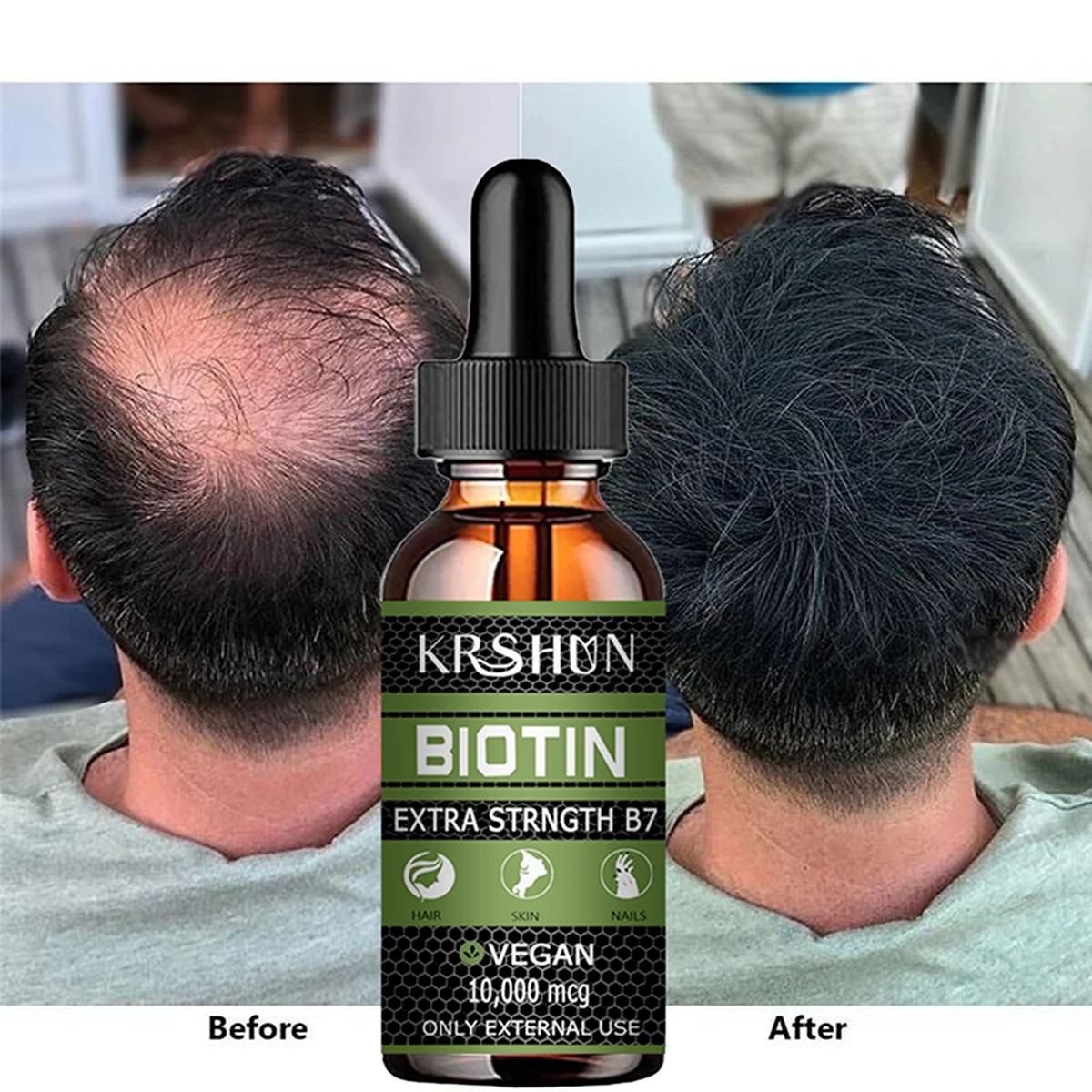 2022 Biotin Fast Hair Growth Oil Hair Regrowth Serum Hair Thinning Treatment Hair Growth Liquid Anti-Hair Loss for Women & Men