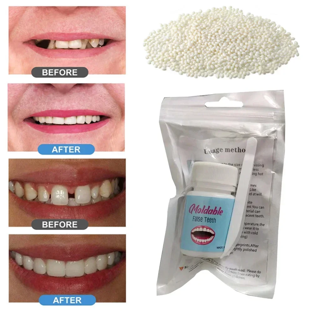 

Sdotter Tooth Filling Repair DIY False Teeth Filler Temporary Tooth Filling Fake Teeth Repair Beads Filling for Teeth