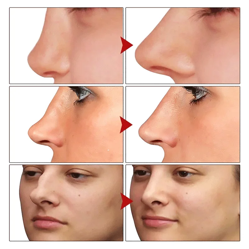 Nose Essential Oil Lift Up Heighten Rhinoplasty Collagen Firming Moisturizing Nose Shape Serum Reshape Natural Face Skin Care