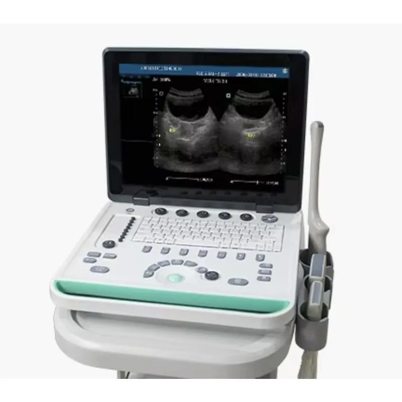 Laptop Ultrasound Scanner  for Women With Baby