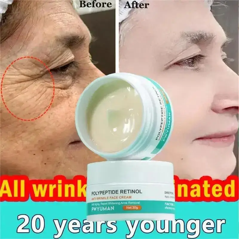 Retinol Anti-Wrinkle Cream Remove Face Neck Wrinkle Cream Lifting Firming Fade Fine Lines Whitening Moisturize Skin Care Product